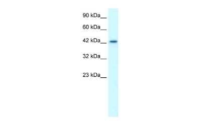 Western Blot LHX3 Antibody