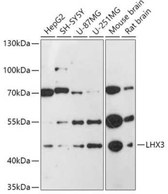 Western Blot: LHX3 Antibody [NBP3-03943] - Analysis of extracts of various cell lines, using LHx3 antibody at 1:1000 dilution. Secondary antibody: HRP Goat Anti-Rabbit IgG (H+L) at 1:10000 dilution. Lysates/proteins: 25ug per lane. Blocking buffer: 3% nonfat dry milk in TBST. Detection: ECL Basic  Kit.