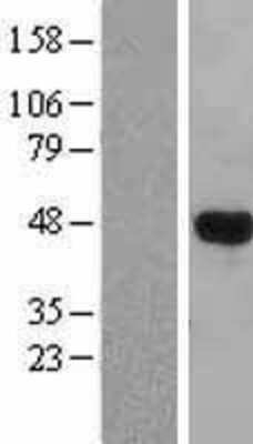 Western Blot LHX3 Overexpression Lysate