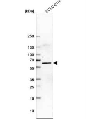 Western Blot: LHX9 Antibody [NBP1-86114] - Analysis in human cell line SCLC-21H.