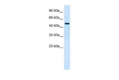 Western Blot: LHX9 Antibody [NBP2-87728] - WB Suggested Anti-LHX9 Antibody Titration: 1.25ug/ml. ELISA Titer: 1:62500. Positive Control: Jurkat cell lysate