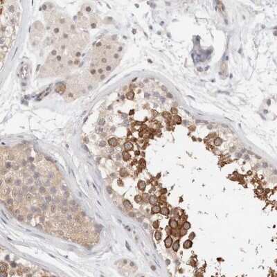 Immunohistochemistry-Paraffin: LIAT1 Antibody [NBP1-81295] - Staining of human testis shows strong cytoplasmic positivity in subsets of seminiferus duct cells.
