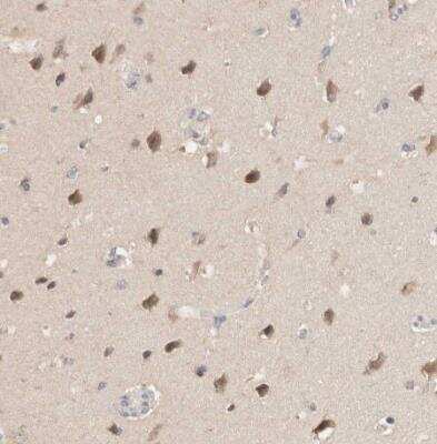 Immunohistochemistry-Paraffin: LIAT1 Antibody [NBP1-81295] - Staining of human cerebreal cortex shows weak cytoplasmic positivity in neurons. 