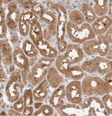 Immunohistochemistry-Paraffin: LIAT1 Antibody [NBP1-81295] - Staining of human kidney shows moderate cytoplasmic positivity in cells in tubules.