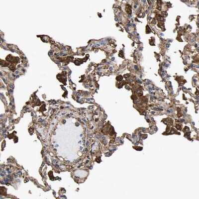Immunohistochemistry-Paraffin: LIF Antibody [NBP1-85717] - Staining of human lung shows strong cytoplasmic positivity.