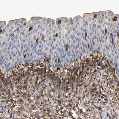 Immunohistochemistry-Paraffin: LIF Antibody [NBP1-85717] - Staining of human urinary bladder shows moderate cytoplasmic positivity.