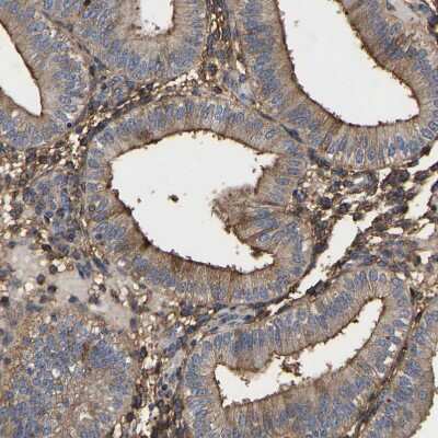 Immunohistochemistry-Paraffin: LIF Antibody [NBP1-85717] - Staining of human endometrium shows strong positivity in cilia.