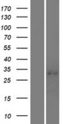 Western Blot: LILRA5 Overexpression Lysate (Adult Normal) [NBP2-06535] Left-Empty vector transfected control cell lysate (HEK293 cell lysate); Right -Over-expression Lysate for LILRA5.