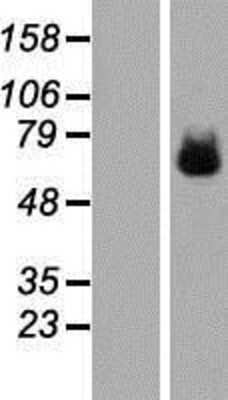 Western Blot: LILRB1 Overexpression Lysate (Adult Normal) [NBP2-07594] Left-Empty vector transfected control cell lysate (HEK293 cell lysate); Right -Over-expression Lysate for LILRB1.