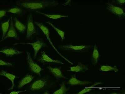 Immunocytochemistry/Immunofluorescence: LIM Kinase 1 Antibody [H00003984-D01P] - Analysis of antibody to LIMK1 on HeLa cell. Antibody concentration 10 ug/ml.