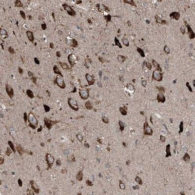 Immunohistochemistry-Paraffin: LIM Kinase 1 Antibody [NBP1-87721] - Staining of human cerebral cortex shows strong cytoplasmic positivity in neuronal cells.