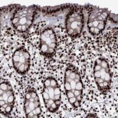 Immunohistochemistry-Paraffin: LIM Kinase 1 Antibody [NBP3-17638] - Staining of human rectum shows strong nuclear positivity in glandular cells.