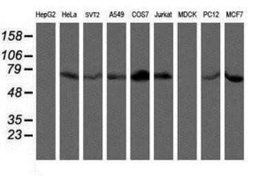 Western Blot: LIM Kinase 1 Antibody (OTI3H6) - Azide and BSA Free [NBP2-71141] - Analysis of extracts (35ug) from 9 different cell lines by using anti-LIM Kinase 1 monoclonal antibody.