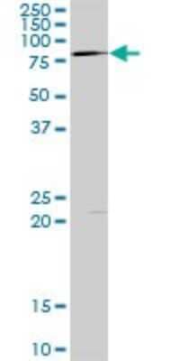 Western Blot: LIM Kinase 1 Antibody [H00003984-D01P] - Analysis of LIMK1 expression in mouse brain.