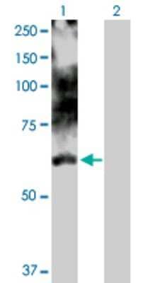Western Blot: LIM Kinase 1 Antibody [H00003984-D01P] - Analysis of LIMK1 expression in transfected 293T cell line by LIMK1 polyclonal antibody.Lane 1: LIMK1 transfected lysate(71.17 KDa).Lane 2: Non-transfected lysate.