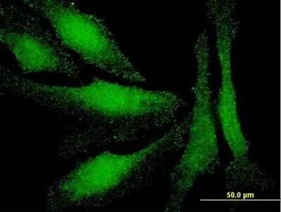 Immunocytochemistry/ Immunofluorescence LIM domain only 3 Antibody (4C4)