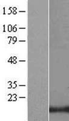 Western Blot LIM domain only 3 Overexpression Lysate