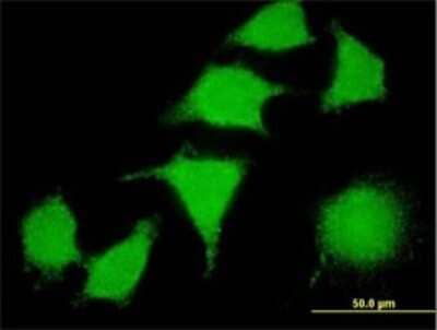 Immunocytochemistry/Immunofluorescence: LIM kinase 2 Antibody (2H2-E11) [H00003985-M01] - Analysis of monoclonal antibody to LIMK2 on HeLa cell . Antibody concentration 10 ug/ml.