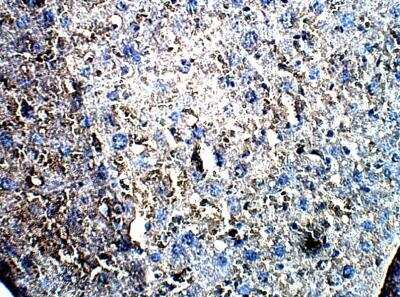 Immunohistochemistry-Paraffin: LIM kinase 2 Antibody [NBP3-12321] - Mouse Liver. 1:50 dilution in IHC blocking buffer. DAB (brown) staining and Hematoxylin QS (blue) counterstain. 40X magnification.