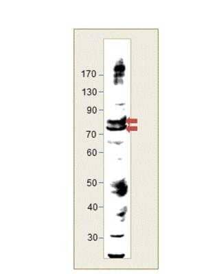 Immunohistochemistry-Paraffin LIM kinase 2 Antibody