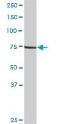 Western Blot: LIM kinase 2 Antibody [H00003985-D01P] - Analysis of LIMK2 expression in human liver.