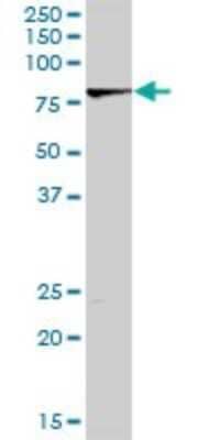 Western Blot: LIM kinase 2 Antibody [H00003985-D01P] - Analysis of LIMK2 expression in mouse kidney.