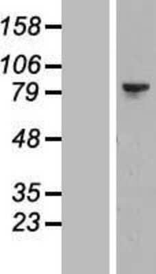 Western Blot LIM kinase 2 Overexpression Lysate