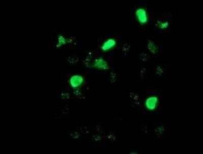 Immunocytochemistry/Immunofluorescence: LIM1 Antibody (OTI2D5) - Azide and BSA Free [NBP2-71134] - Staining of COS7 cells transiently transfected by pCMV6-ENTRY LIM1.