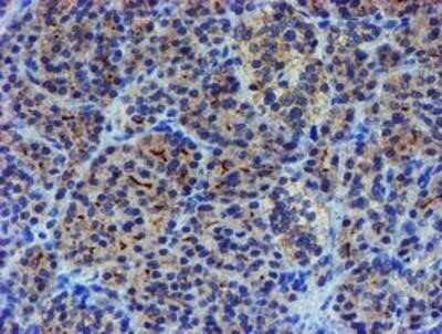 Immunohistochemistry: LIM1 Antibody (OTI2D5) - Azide and BSA Free [NBP2-71134] - Staining of paraffin-embedded Human pancreas tissue using anti-LIM1 mouse monoclonal antibody.