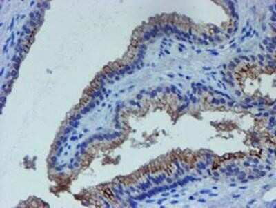 Immunohistochemistry: LIM1 Antibody (OTI2D5) - Azide and BSA Free [NBP2-71134] - Staining of paraffin-embedded Human prostate tissue using anti-LIM1 mouse monoclonal antibody.