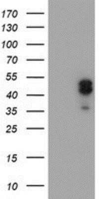 Western Blot: LIM1 Antibody (OTI2D5) - Azide and BSA Free [NBP2-71134] - HEK293T cells were transfected with the pCMV6-ENTRY control (Left lane) or pCMV6-ENTRY LIM1 (Right lane) cDNA for 48 hrs and lysed. Equivalent amounts of cell lysates (5 ug per lane) were separated by SDS-PAGE and immunoblotted with anti-LIM1.