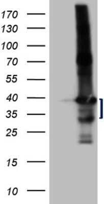 Western Blot: LIME Antibody (OTI5D3) - Azide and BSA Free [NBP2-71974] - Analysis of HEK293T cells were transfected with the pCMV6-ENTRY control (Left lane) or pCMV6-ENTRY LIME1.