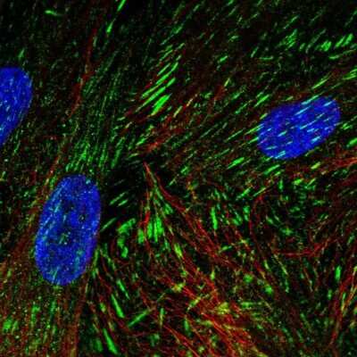 Immunocytochemistry/Immunofluorescence: LIMS2 Antibody [NBP2-31713] - Staining of human cell line BJ shows localization to focal adhesion sites.