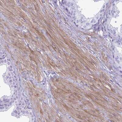 Immunohistochemistry-Paraffin: LIMS2 Antibody [NBP2-31713] - Staining of human prostate shows moderate  membranous positivity in smooth muscle cells.