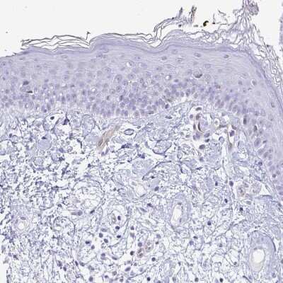 Immunohistochemistry-Paraffin: LIMS2 Antibody [NBP2-31713] - Staining of human skin shows low positivity in squamous epithelial cells as expected.