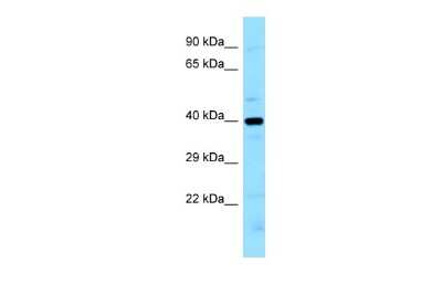 Western Blot: LIMS2 Antibody [NBP2-85209] - WB Suggested Anti-LIMS2 Antibody. Titration: 1.0 ug/ml. Positive Control: MCF7 Whole Cell