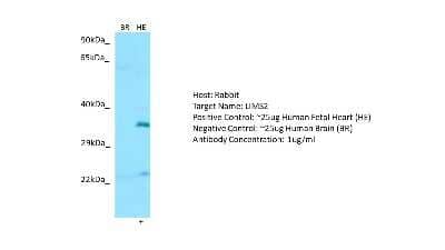 Western Blot: LIMS2 Antibody [NBP2-85209] - Host: Rabbit. Target: LIMS2. Positive control (+): Human Fetal Heart (HE). Negative control (-): Human Brain (BR). Antibody concentration: 1ug/ml