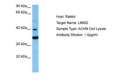 Western Blot: LIMS2 Antibody [NBP2-85210] - Host: Rabbit. Target Name: LIMS2. Sample Tissue: Human ACHN Whole Cell lysates. Antibody Dilution: 1ug/ml