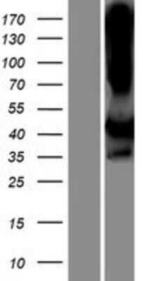 Western Blot: LIMS2 Overexpression Lysate (Adult Normal) [NBP2-06891] Left-Empty vector transfected control cell lysate (HEK293 cell lysate); Right -Over-expression Lysate for LIMS2.