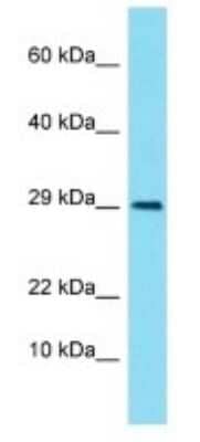 Western Blot: LIMS3 Antibody [NBP3-09748] - Western blot analysis of LIMS3 in Human Fetal Kidney. Antibody dilution at 1ug/ml