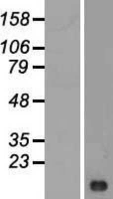 Western Blot: LIMS3 Overexpression Lysate (Adult Normal) [NBL1-12540] Left-Empty vector transfected control cell lysate (HEK293 cell lysate); Right -Over-expression Lysate for LIMS3.