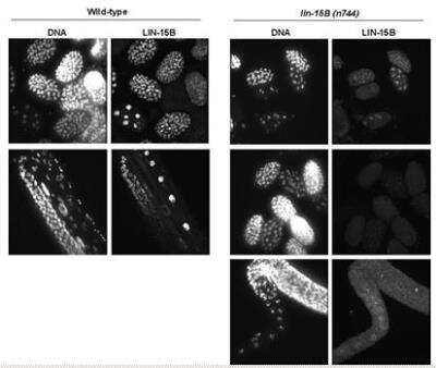 Immunocytochemistry/Immunofluorescence: LIN-15B Antibody [38610002] - This image is specific to animal number SDQ2327 1:10,000 of 0.5 mg/ml stock