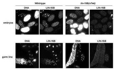 Immunocytochemistry/Immunofluorescence: LIN-15B Antibody [38610002] - This image is specific to animal number SDQ2330 1:10,000 of 0.5 mg/ml stock