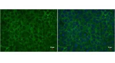 Immunocytochemistry/Immunofluorescence: LIN-28A Antibody (1086) [NBP2-43673] - Analysis of human embryonic stem cell were fixed in 4% paraformaldehyde for 15 min. Green: LIN28 protein stained by LIN28 antibody diluted at 1:500. Blue: Hoechst 33342 staining. Scale bar = 10 um.