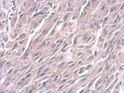 Immunohistochemistry-Paraffin: LIN-28A Antibody (1086) [NBP2-43673] - Analysis of U87 xenograft. Lin28A antibody dilution: 1:100.