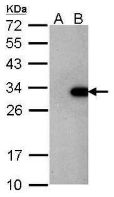 Western Blot: LIN-28A Antibody (1086) [NBP2-43673] - Analysis of 30 ug whole cell lysate. A: Non-transfected HeLa lysates B: LIN28 transfected HeLa lysates 12% SDS PAGE diluted at 1:1000. .