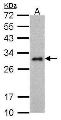 Western Blot: LIN-28A Antibody (1086) [NBP2-43673] - Analysis of 30 ug whole cell lysate. A: NT2D1 12% SDS PAGE diluted at 1:1000.