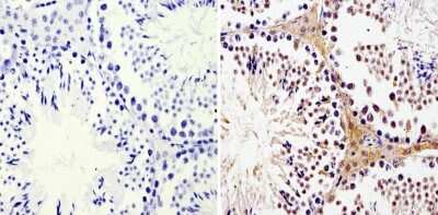 Immunohistochemistry-Paraffin: LIN-28A Antibody (14E6-4E6) [NBP2-22481] - Analysis showing staining in the nucleus and cytoplasm of mouse testis tissue (right) compared with a negative control without primary antibody (left).