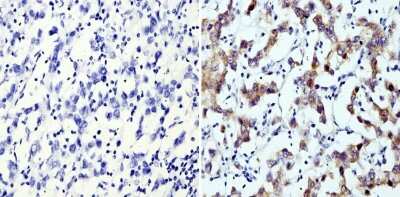 Immunohistochemistry-Paraffin: LIN-28A Antibody (14E6-4E6) [NBP2-22481] - Analysis showing staining in the cytoplasm of human seminoma (right) compared with a negative control without primary antibody (left).