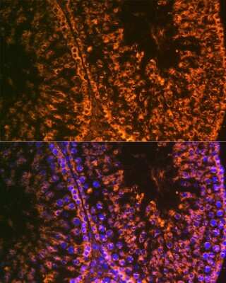 Immunohistochemistry: LIN-28A Antibody (2S1I10) [NBP3-16843] - Immunofluorescence analysis of rat testis using LIN-28A Rabbit mAb (NBP3-16843) at dilution of 1:100 (40x lens). Blue: DAPI for nuclear staining.